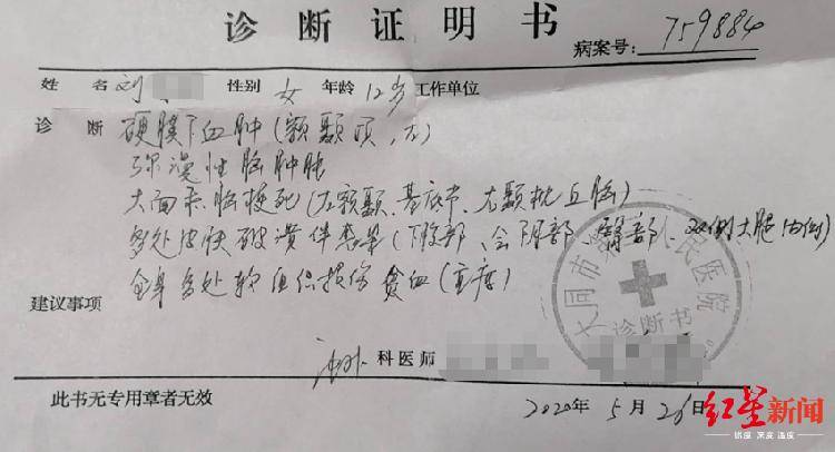 恒耀平台注册山西怀仁12岁女童疑遭继母虐待致脑梗死,检方提前介入 (图6) 恒耀平台注册山西怀仁12岁女童疑遭继母虐待致脑梗死,检方提前介入 (图6)