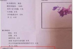 tct和hpv检查都是检查什么?为什么有的时候要联合复查?