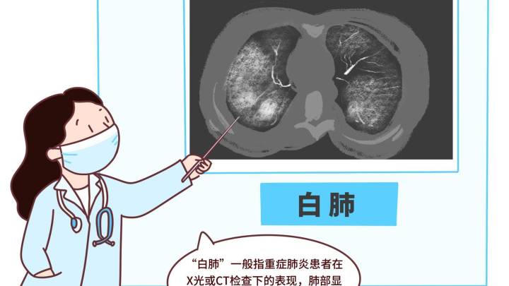 得了甲流,就得吃抗病毒药吗?