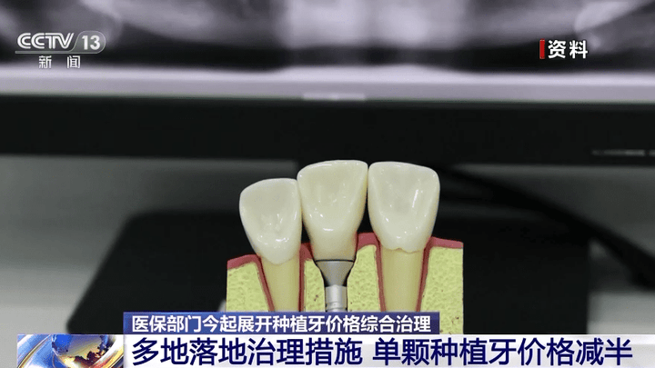 种植牙价格减半,你觉得合理吗?