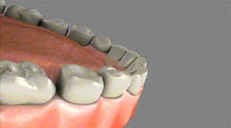牙齿再生或成现实59岁女子参与新药试验后长出牙槽骨