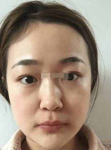 山根低鼻头肥大,缺乏自主能力,适合上班或小生意店