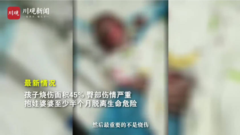 无数人牵挂!成都烧伤女婴脱险,网友2小时捐120万