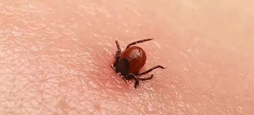蜱虫该怎么防护