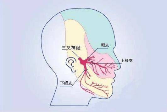 忍饥挨饿20天不敢吃饭,医生用一颗"小梨"解决三叉神经