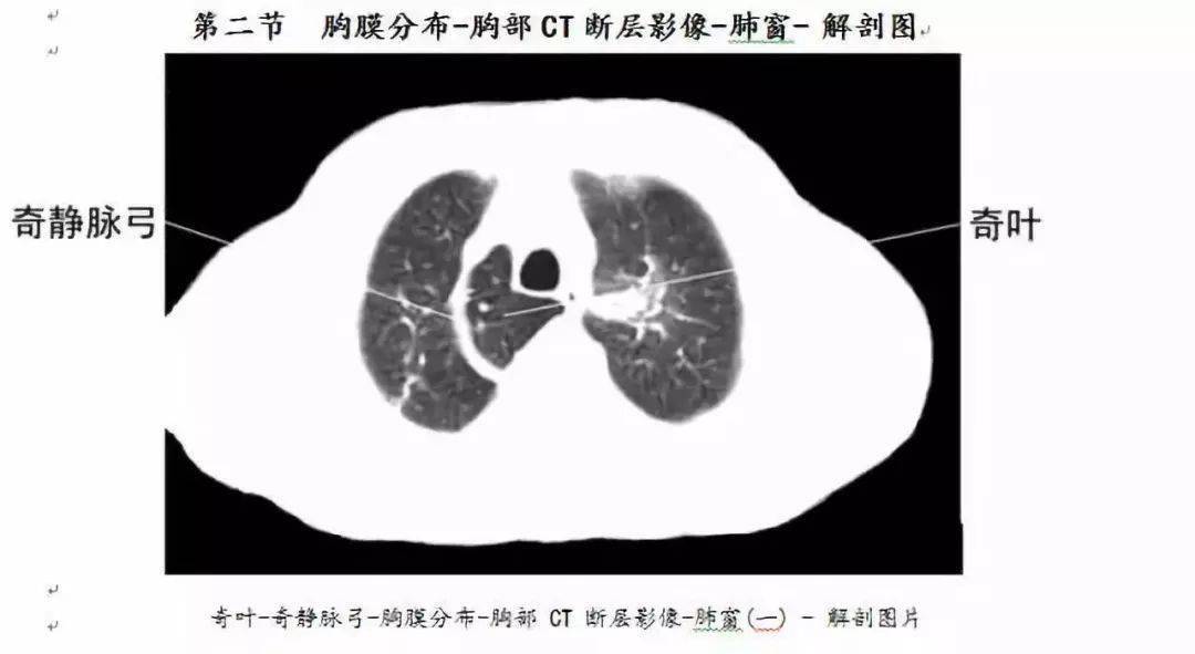 全身ct图谱赶紧收藏了吧