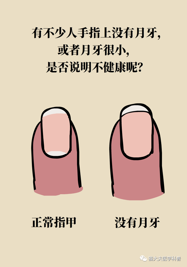 手指甲的变化,暴露了你身体存在的问题