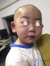 孩子|医生：千万别心怀侥幸宝宝一吃面条或饼干就全身潮红、打寒颤