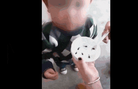 欣源|有可能感染了蛔虫等寄生虫吗？欣源说 | 孩子肚子鼓鼓的
