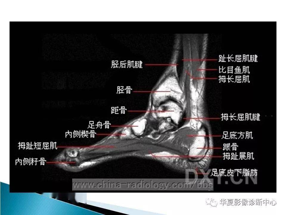 踝关节的解剖及mri扫描技术