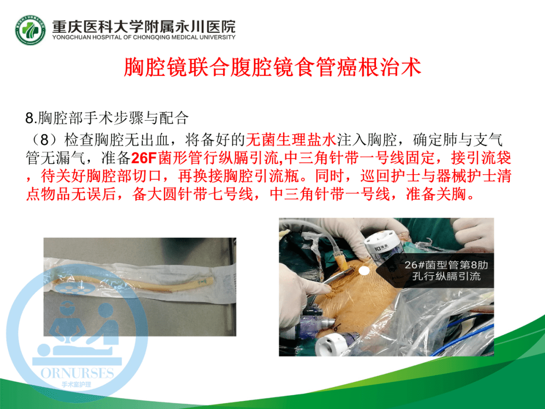 ppt胸腔镜联合腹腔镜食管癌根治术的手术配合