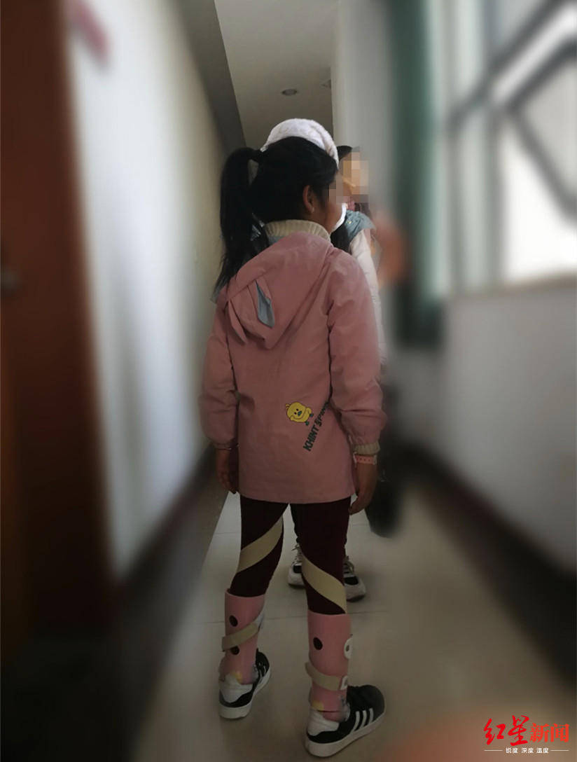 脑瘫|妹妹是她的“拐杖”!现在,患脑瘫的她终于可以独立行走了曾经