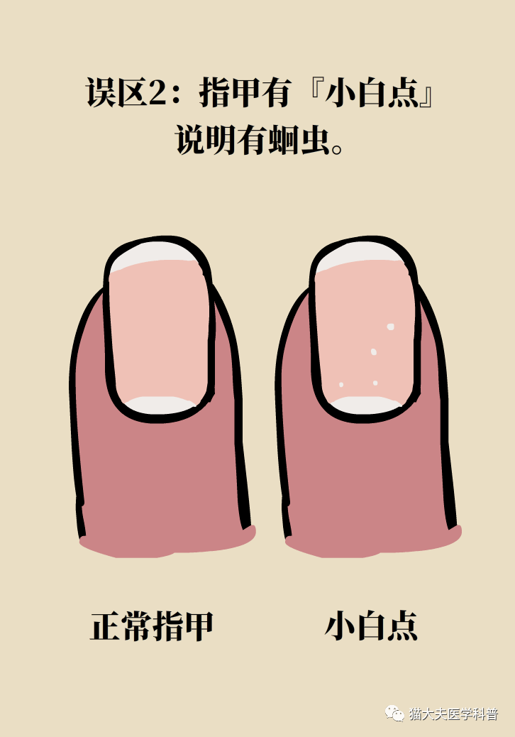指甲上没月牙身体不健康