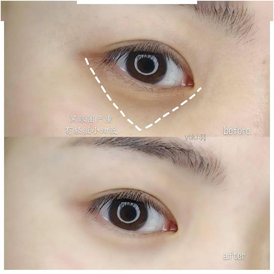 瑞典33位女性经3个月实测：变态眼霜把70岁奶奶的眼纹淡化了，还消水肿