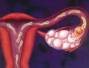 女人怎么会得卵巢囊肿 ec02671743624900a2539d2a4c98fccb.jpeg