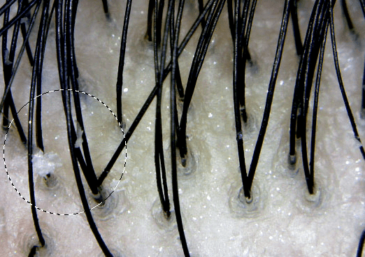 李佳琦推荐的脱发克星!一次就能拯救头屑头痒头油,用了它头发都会跳舞!