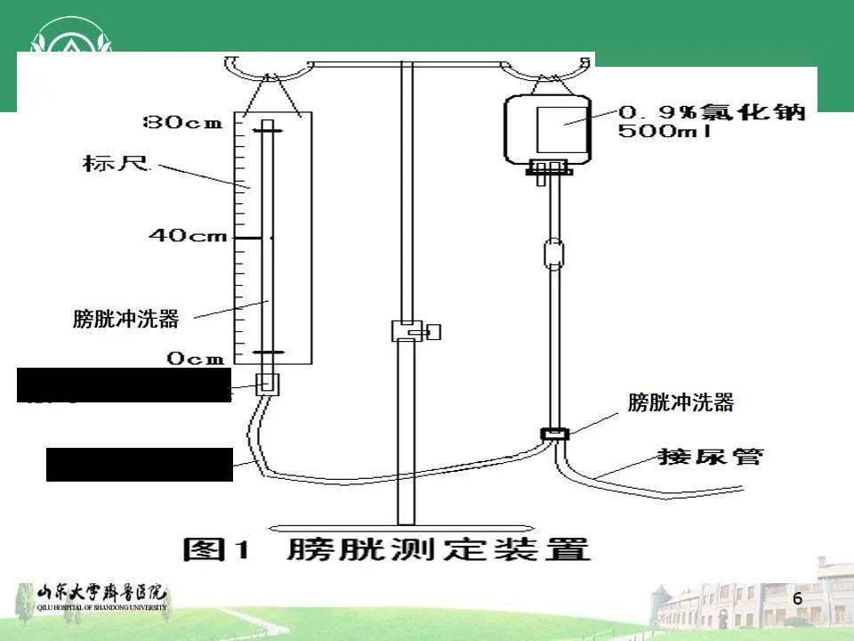 【ppt】膀胱容量与压力测定