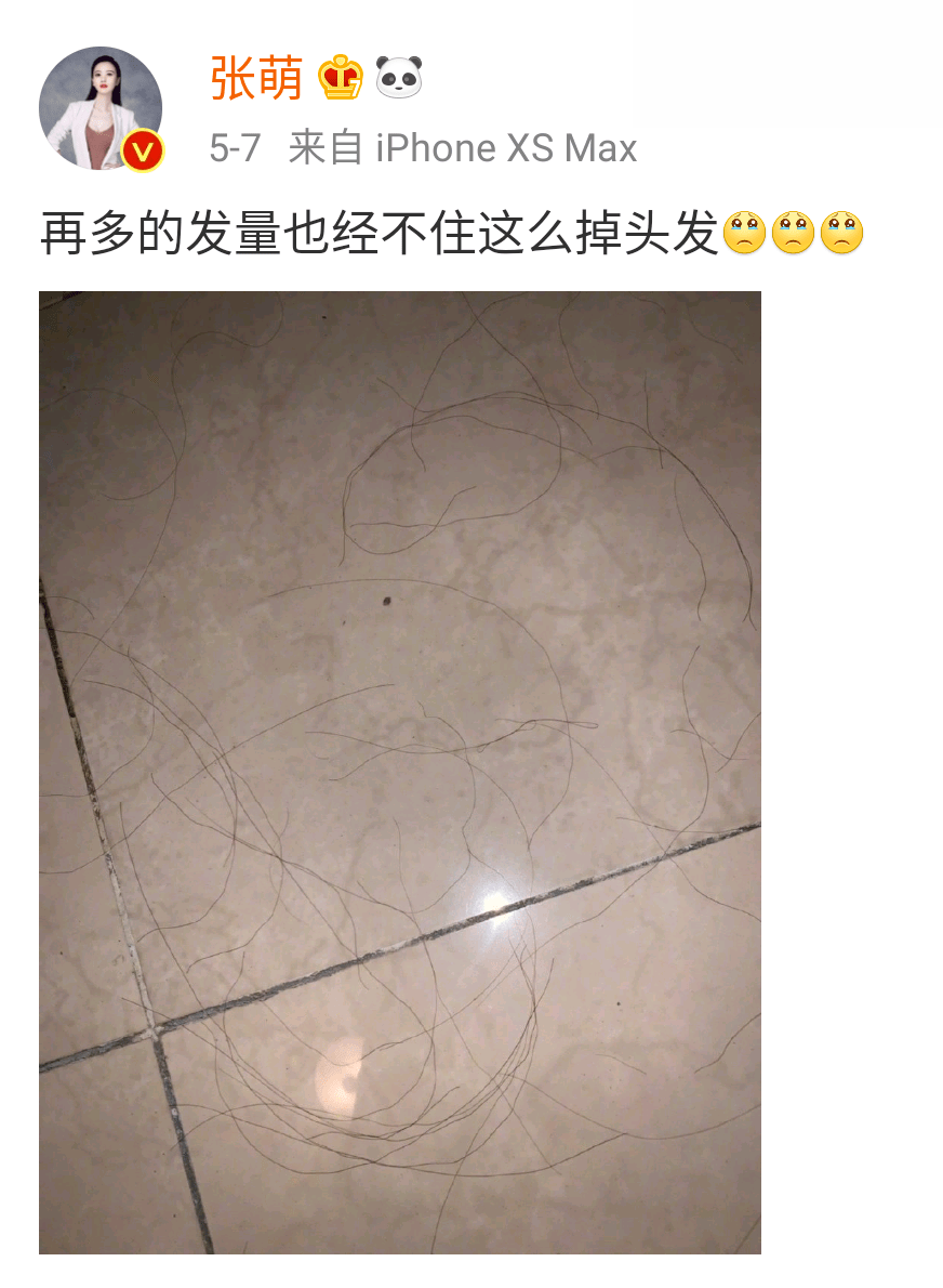 李佳琦推荐的脱发克星!一次就能拯救头屑头痒头油,用了它头发都会跳舞!