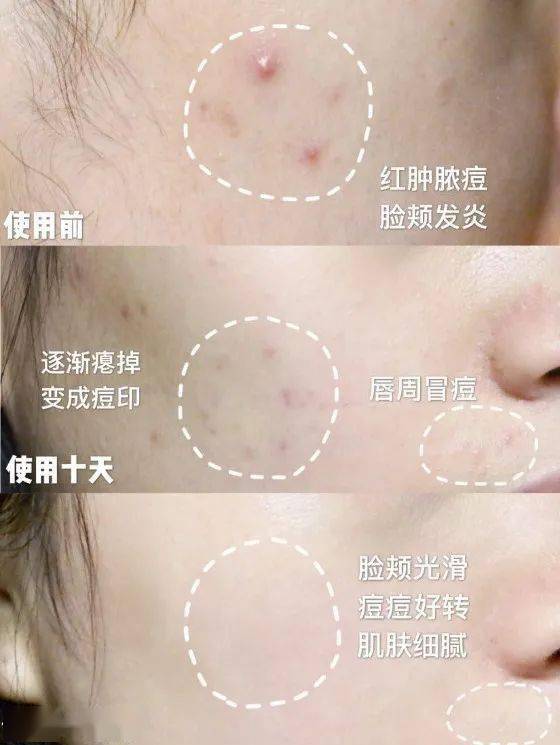 沈梦辰这脸变的!《乘风破浪》这皮肤状态,估计花了不少钱吧?