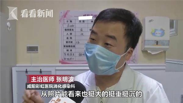 1岁女童哭闹不止医生从胃里取出直径2cm金戒指