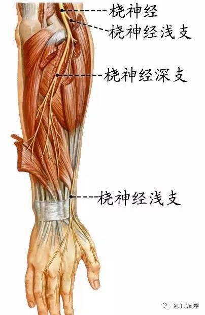 臂丛的临床应用 肱骨中段骨折易损伤桡神经,导致上肢伸肌瘫痪而出现"