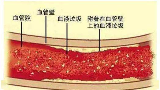 高血压,糖尿病,高血脂的真相,看明白多活十几年!