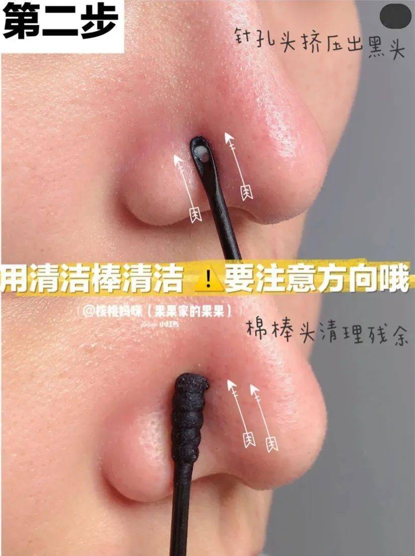 毛孔|原来想要拥有干净、清透的“初恋素颜脸”，只需要做好这一步！