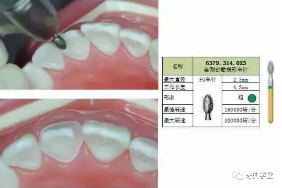 口腔诊查设备1实博体育70101牙周袋探测设备器械产品描述器械举例