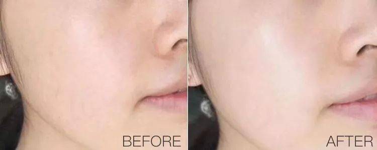 大麻|女生想要的适合,无非是这个样子的。