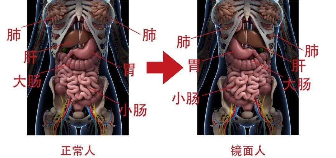 江西一女子的五脏六腑竟全部长反了!