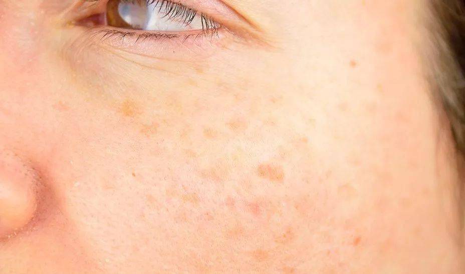 戴上立|99%防晒！戴上立降10℃ ，显瘦5斤，扔掉你又丑又闷又没用的捂脸布吧！360°“V”脸的它才是王道