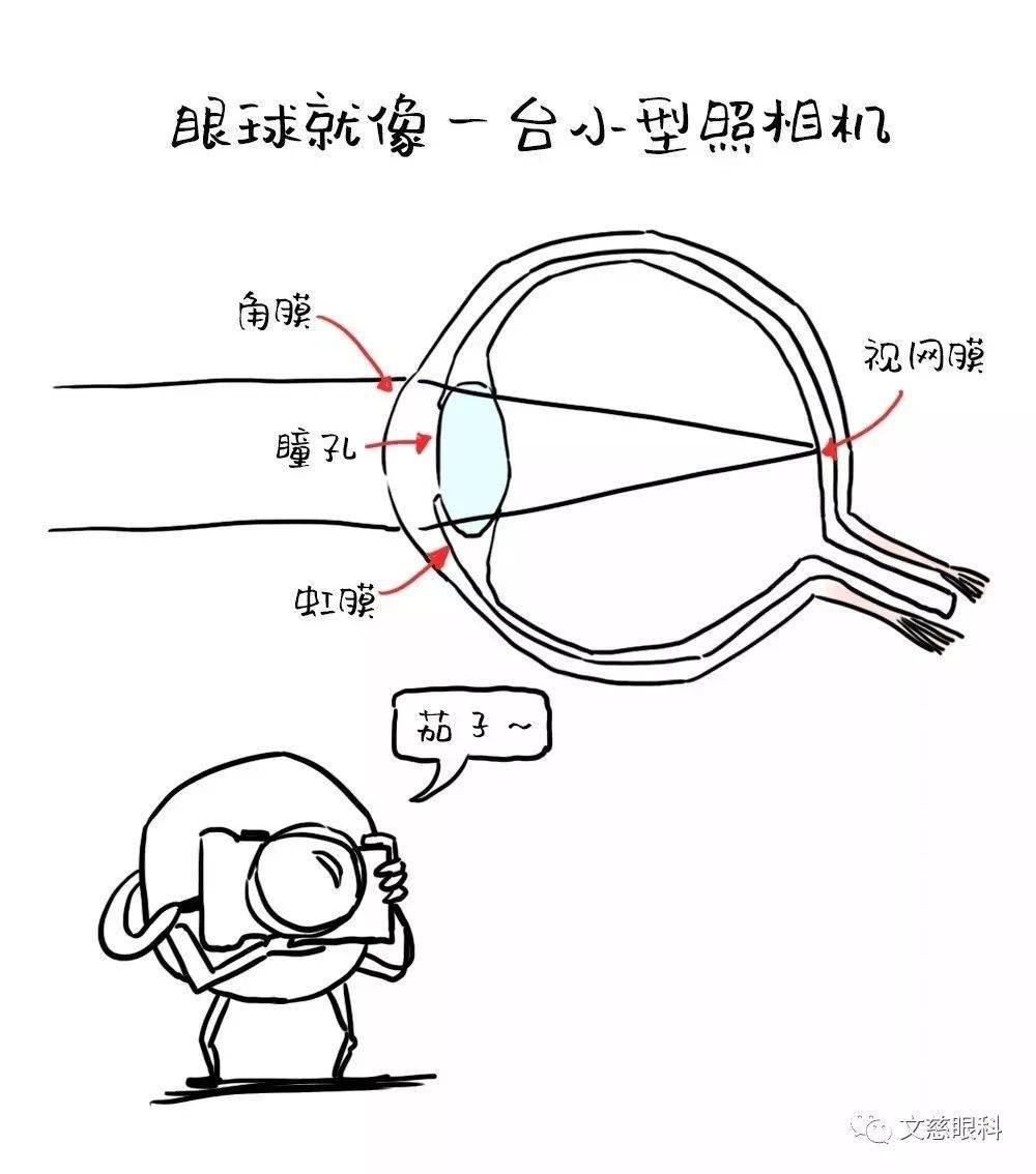 激光近视手术原理图 474ecd65b64245d3945280bc8720b062.jpeg