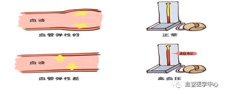 一起了解血管检测