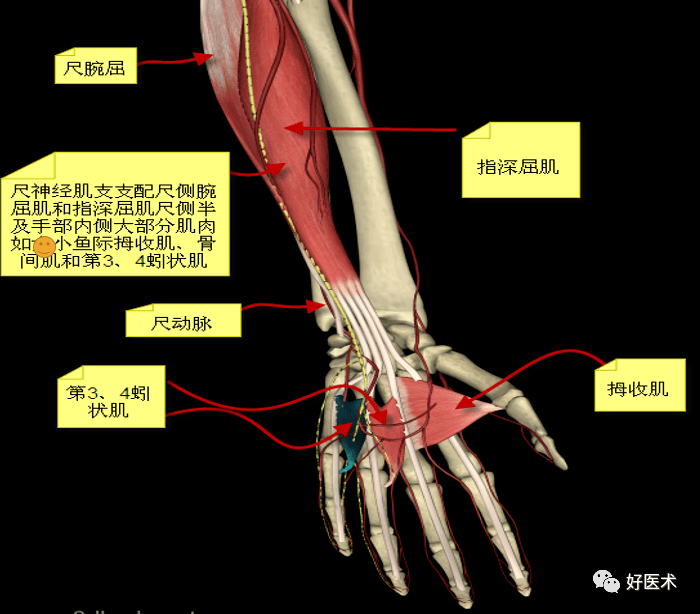 短屈肌,小指对掌肌,所有骨间肌,第3,4蚯状肌,拇内收肌及拇短屈肌深头
