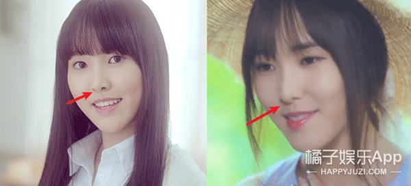 五官|整坏了?这是要找医生赔偿的程度…