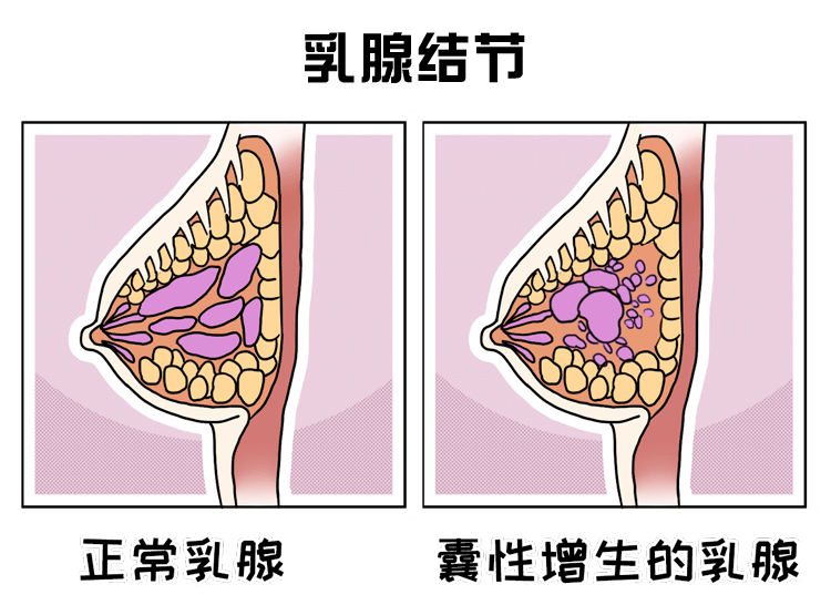 身上这些部位有凸起,可能是癌症前兆!