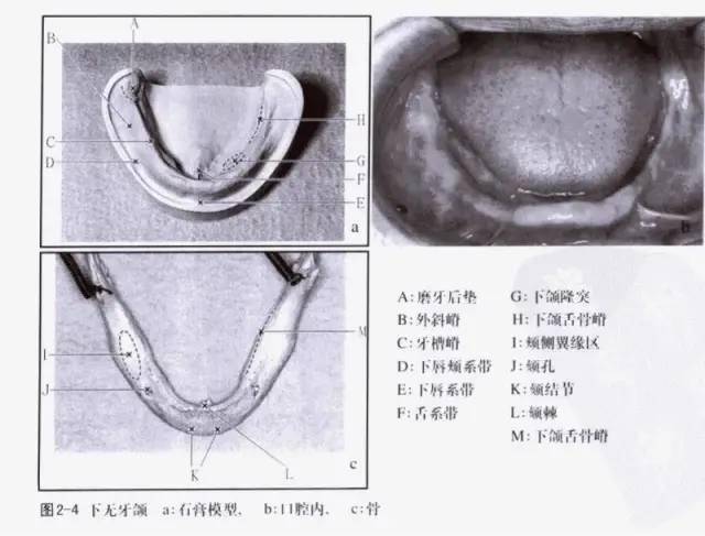 先整体的了解一下上下颌的解剖标志然后再一个个地分析它们与假牙