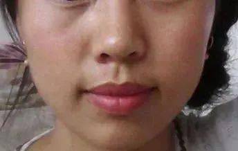 角质|能搓出“脏东西”的它3秒卖出一瓶！去角质、黑头、收毛孔，给你肌肤来次“大扫除”!