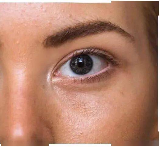 角质|能搓出“脏东西”的它3秒卖出一瓶！去角质、黑头、收毛孔，给你肌肤来次“大扫除”!