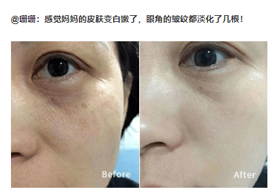 肌肤|40岁的逆袭 聪明的女人保鲜用这招