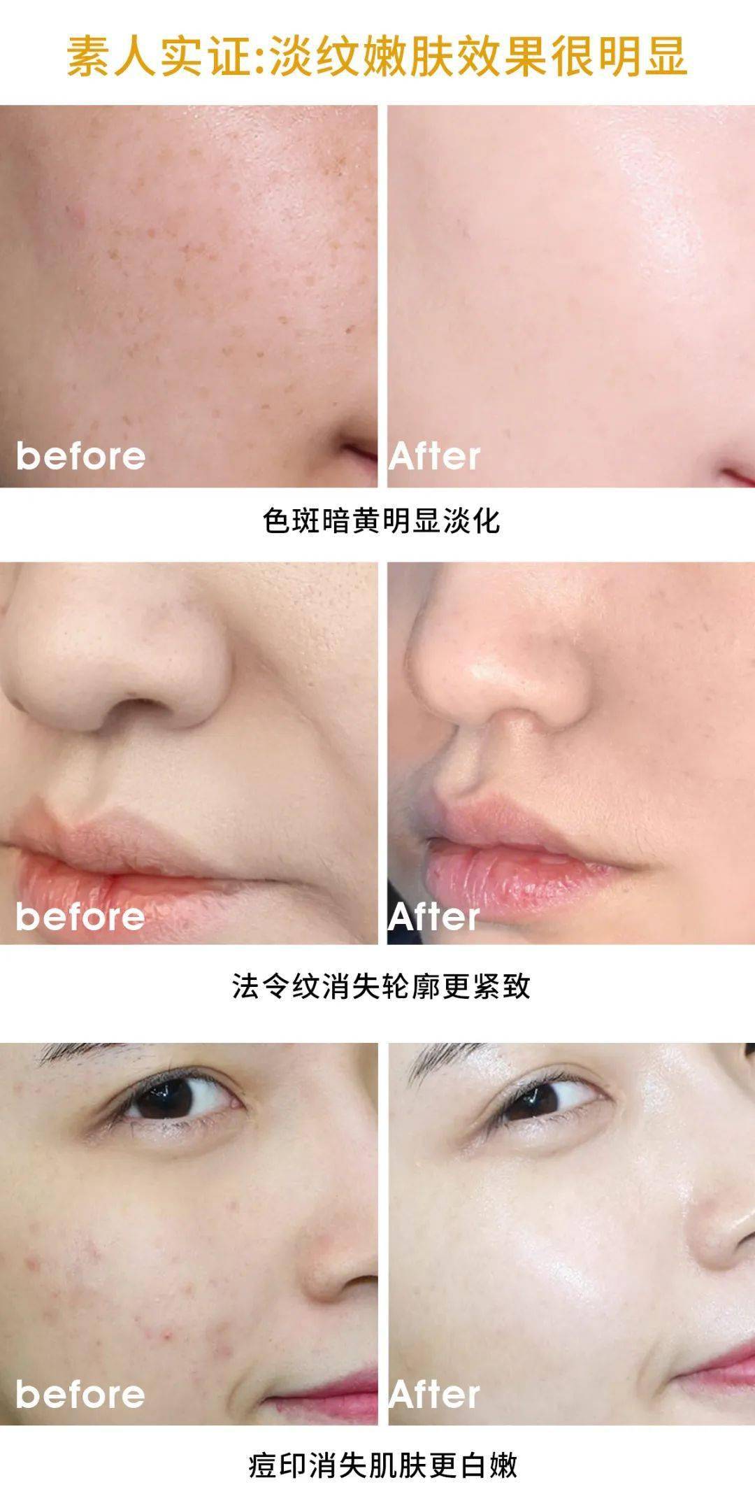 肌肤|40岁的逆袭 聪明的女人保鲜用这招