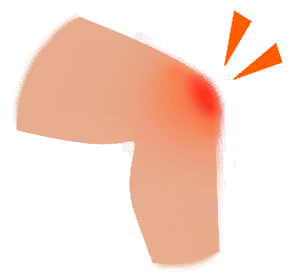 进行|糖尿病怎么控制血糖?记住这些就够了