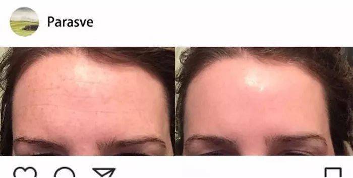 鲜肉|“少女脸”奶奶惊艳全球,61岁又泡到28岁鲜肉,网友:好狠,这女的!