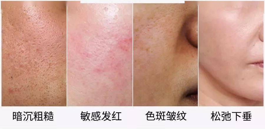 面膜|官宣？！《乘风破浪的姐姐》保养C位出圈的绝对是她...