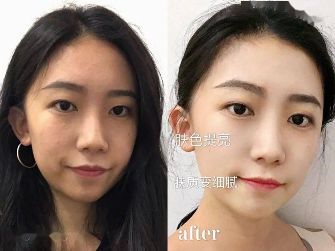 黑色素|薇娅直播间1分钟卖出10000瓶的美白精华，真的好用吗？