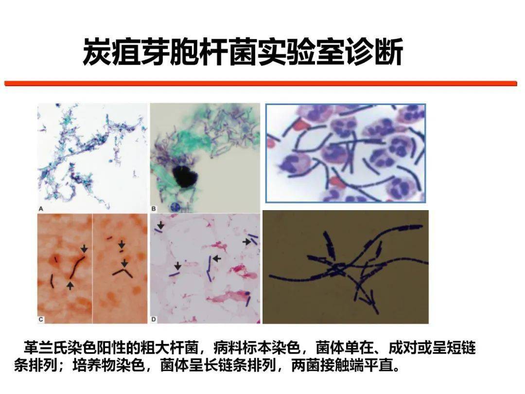 【培训视频】人兽共患病防控系列培训之动物炭疽的防控