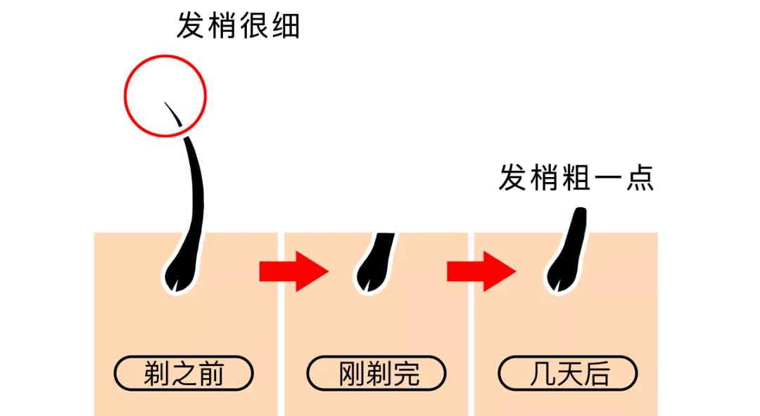 永久|疯狂抢！广东这家店99元永久脱毛！错过就亏大了！
