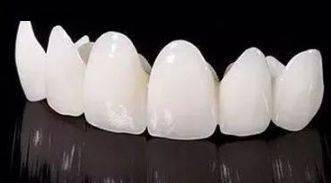 牙医建议您选【氧化锆全瓷牙】 因为阻碍磁共振=无法第一时间抢救生命
