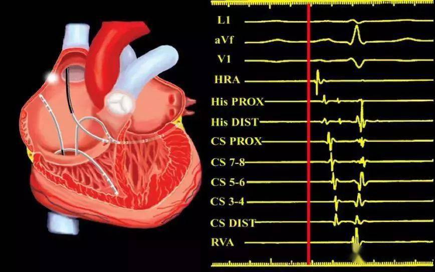心脏电生理基础知识