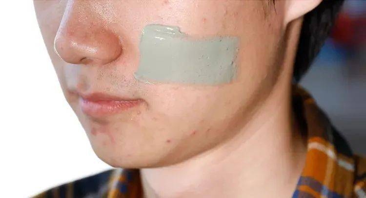 吸铁石|新西兰百年历史“污垢吸铁石”,15分钟告别黑头、粉刺、闭口!